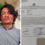 Gawat Aneh Tapi Nyata,Seorang Wartawan Korban Penganiayaan Malah Jadi Tersangka di Nias Selatan