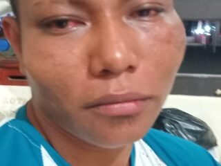 Warga Desa Wowonda Diduga Dianiaya Dua Anggota Polisi Polres KKT