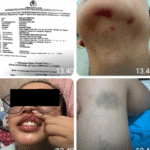 Kinerja Unit PPA Polres Tangsel Tidak Profesional, Kasus KDRT Sejak Tahun 2024 Hingga Kini Mandek