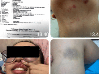 Kinerja Unit PPA Polres Tangsel Tidak Profesional, Kasus KDRT Sejak Tahun 2024 Hingga Kini Mandek