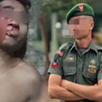 Dugaan Penganiayaan di Lahusa Seret Nama Oknum TNI dan Kepala Desa, Korban Tempuh Jalur Hukum