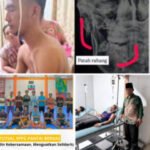 Anak Ulama Bengkulu Mengalami Patah Rahang, Terkait Dugaan Pengeroyokan oleh Oknum SPPG Pantai Berkas. 