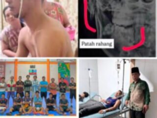 Anak Ulama Bengkulu Mengalami Patah Rahang, Terkait Dugaan Pengeroyokan oleh Oknum SPPG Pantai Berkas. 