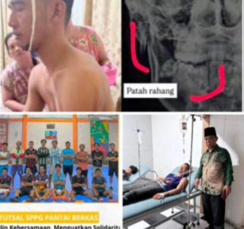Anak Ulama Bengkulu Mengalami Patah Rahang, Terkait Dugaan Pengeroyokan oleh Oknum SPPG Pantai Berkas. 