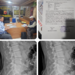Diduga Dianiaya Satpam BPN Kota Bandung, Anggota LSM KOREK Lapor Polisi*