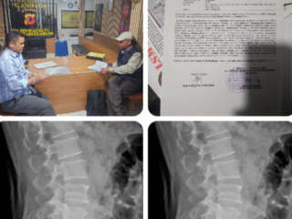 Diduga Dianiaya Satpam BPN Kota Bandung, Anggota LSM KOREK Lapor Polisi*